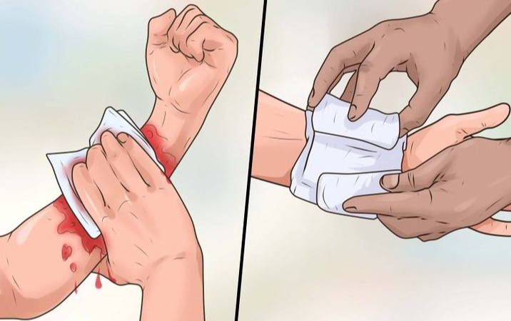 Giải đáp thắc mắc: Bị chó cắn 1 tháng có tiêm phòng được không? 4