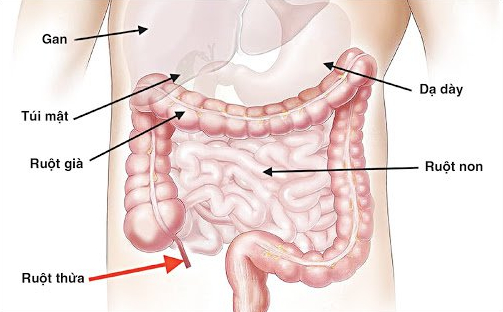 Giải đáp thắc mắc: Mổ ruột thừa bao lâu thì ăn uống bình thường? 2
