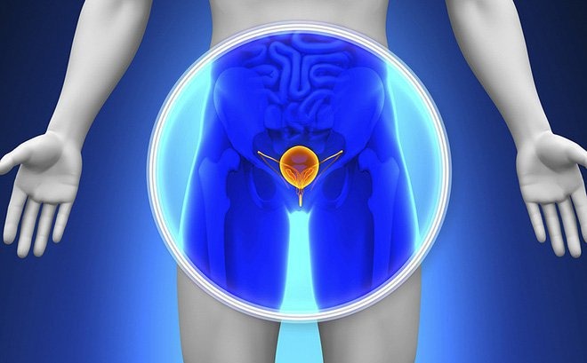 Giải đáp thắc mắc: Sinh thiết tuyến tiền liệt bao lâu có kết quả? 2