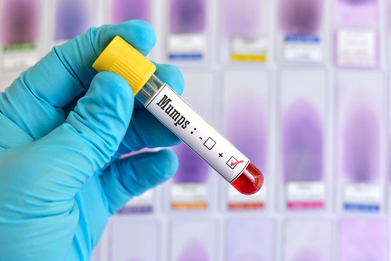 Giải đáp: Tiêm vắc xin quai bị rồi có bị nữa không? 5