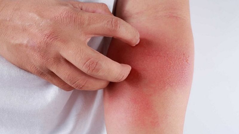 Giải đáp: Tiểu đường tuýp 2 có nên chích insulin không? 4