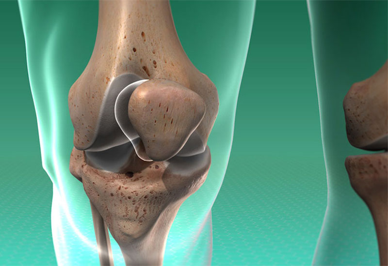 Giải đáp: Vỡ xương bánh chè bao lâu thì đi được? 1