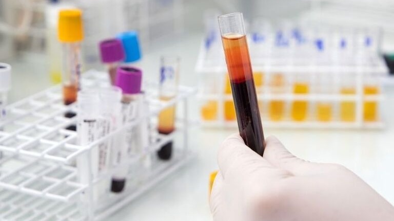 Giải đáp y khoa: Xét nghiệm NIPT rồi có cần làm thêm Double Test không? 3