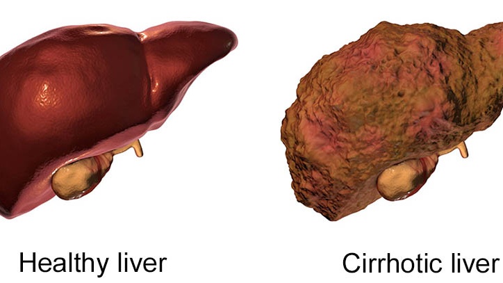 Giải phẫu thực quản: Tìm hiểu về chức năng của thực quản và các bệnh lý liên quan 4