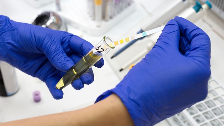 giai-thich-cac-chi-so-kham-suc-khoe-tong-quat 3.jpg