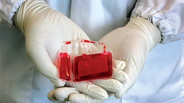 Giữ cuống rốn để làm gì? Những lưu ý cần biết 3