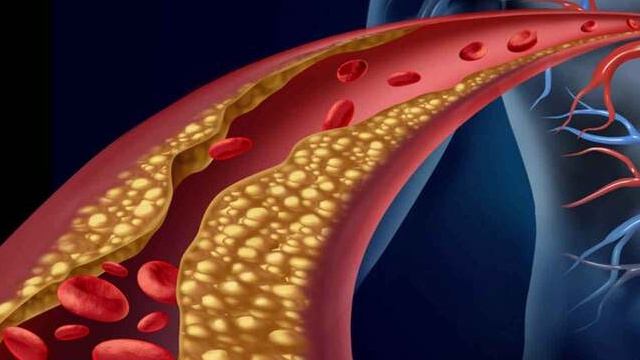 Góc giải đáp: Sản phẩm viên uống Fucoidan Okinawa Nhật Bản có mấy loại? 3