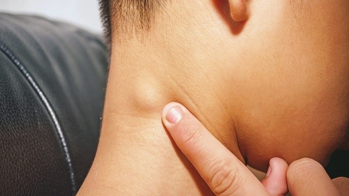 hach-bat-thuong-o-co-nguyen-nhan-chan-doan-va-cach-dieu-tri 1