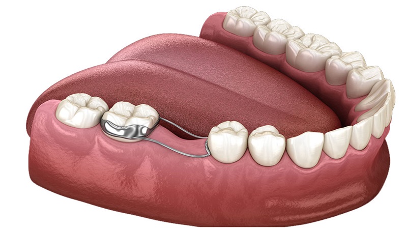 Hàm giữ khoảng: Khái niệm, phân loại và công dụng chính 1