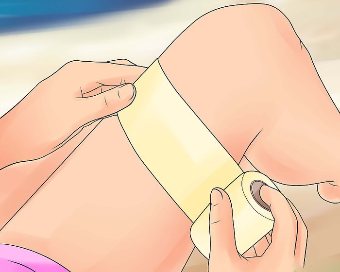 Hạn chế tối đa tổn thương với cách sơ cứu bỏng sứa đơn giản và chính xác 3