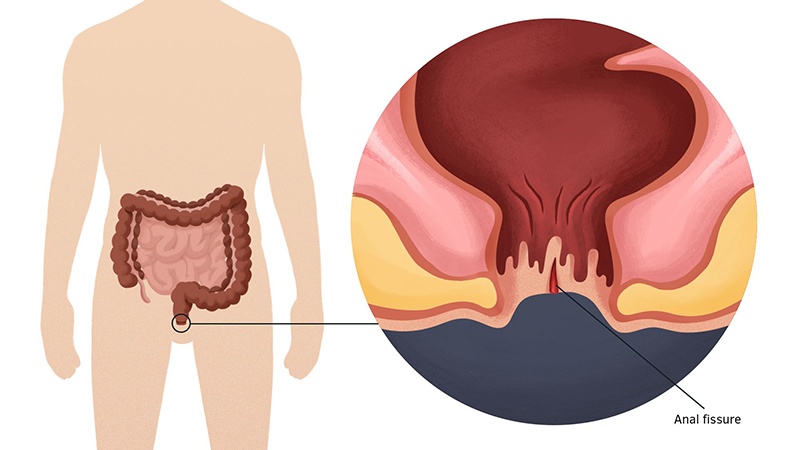 Hậu môn bình thường có cấu tạo và chức năng như thế nào? 2
