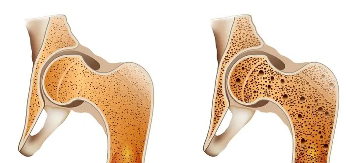 Hãy chăm sóc sức khỏe của mẹ 2