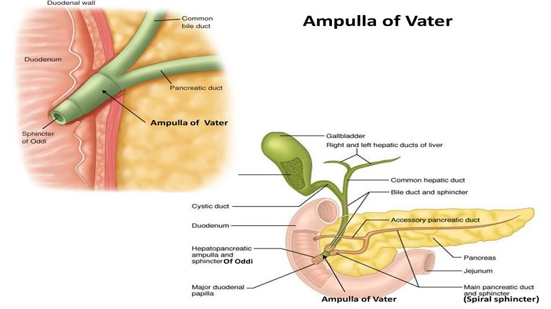 Hẹp bóng Vater: Nguyên nhân, chẩn đoán và điều trị 1
