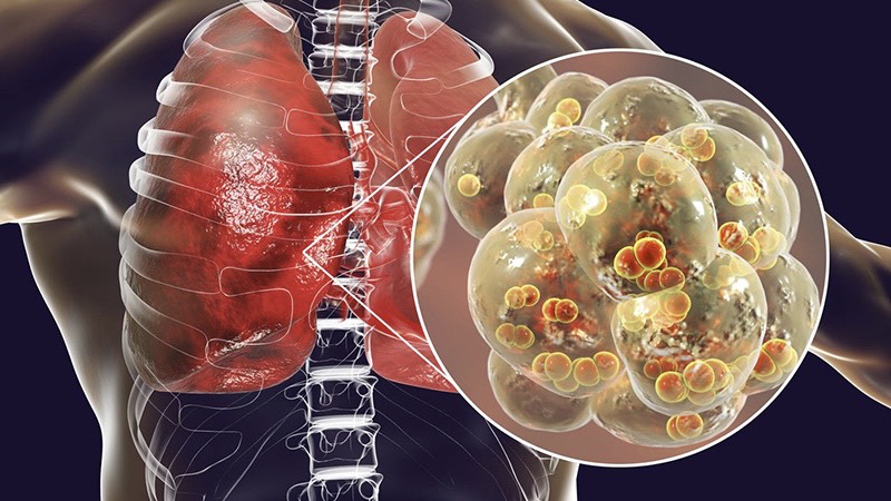 hieu-ve-tang-co-2-mau-nguy-co-tiem-an-va-cach-khac-phuc 2