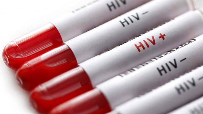 HIV 1 và 2 là gì? Khác nhau thế nào? 4