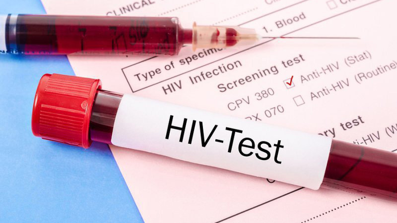 HIV 1 và 2 là gì? Khác nhau thế nào? 1