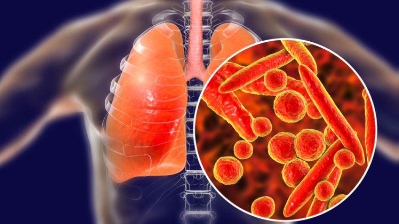 Ho nhiều có sao không và các cách giảm ho hiệu quả 2