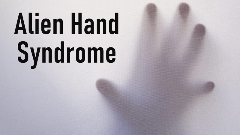 Hội chứng bàn tay người ngoài hành tinh và các thông tin cần biết 3