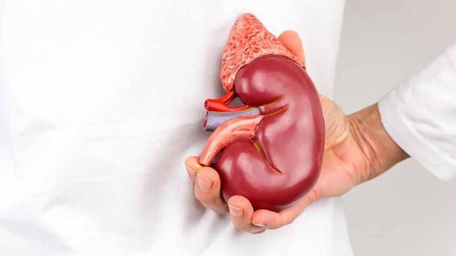 Hội chứng Conn: Nguyên nhân, triệu chứng, cách chẩn đoán và điều trị 3