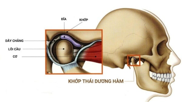 Hội chứng rối loạn TMJ - Rối loạn khớp thái dương hàm 1