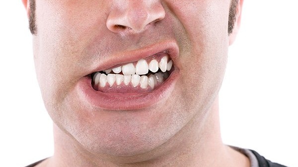 Hội chứng rối loạn TMJ - Rối loạn khớp thái dương hàm 3