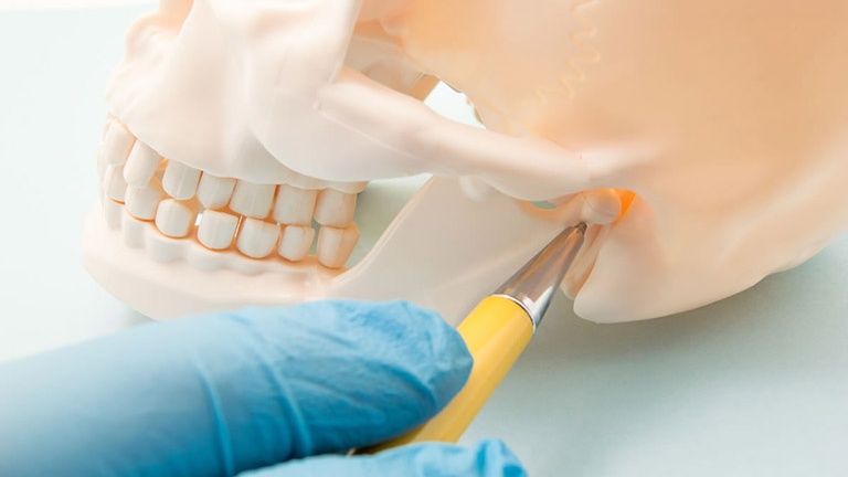 Hội chứng rối loạn TMJ - Rối loạn khớp thái dương hàm 4