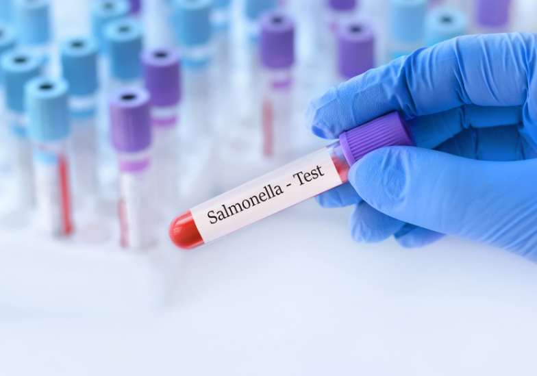 Hội chứng ruột kích thích sau nhiễm trùng: Nguy cơ, triệu chứng và cách điều trị 2