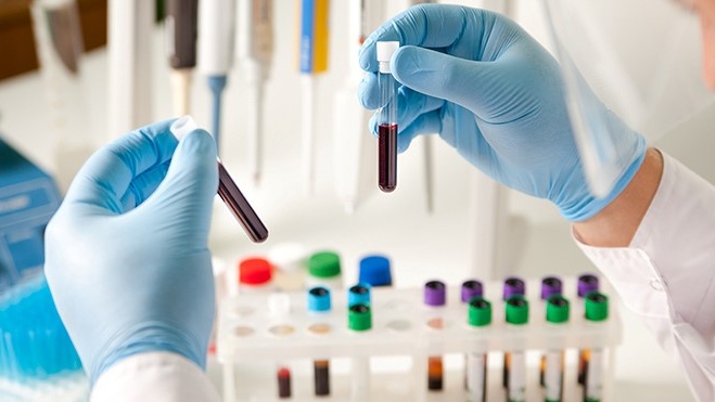 Hội chứng ure máu cao – Nguyên nhân và cách điều trị 3