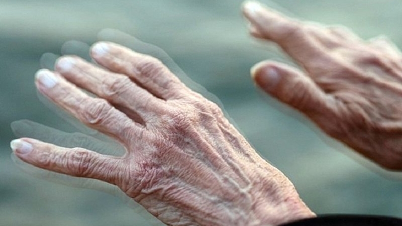 Hội chứng Zombie: Nguyên nhân, chẩn đoán và điều trị 2