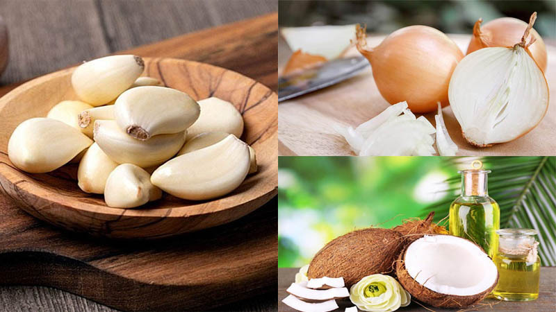 Bỏ túi cách khắc phục tình trạng hói đầu chữ M  1