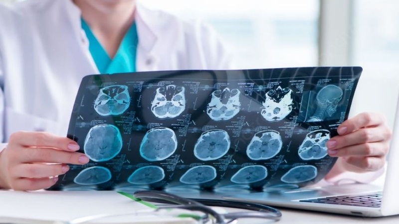 Hôn mê là gì? Nguyên nhân gây hôn mê thường gặp 3