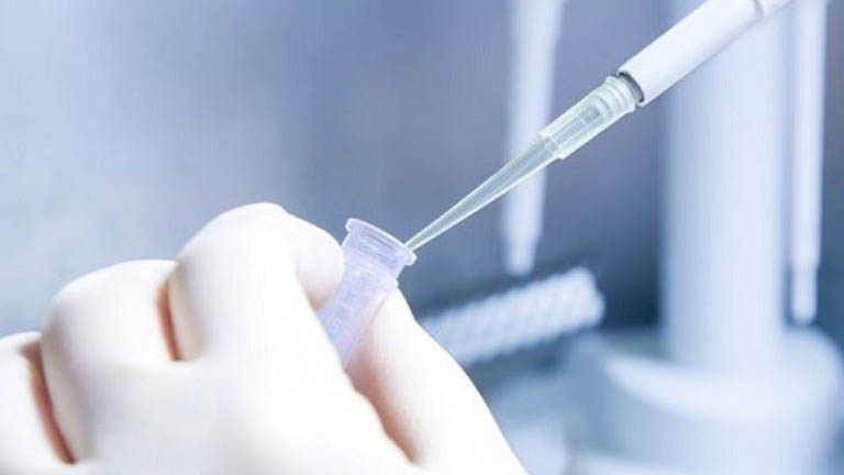 Hướng dẫn cách đọc kết quả xét nghiệm HBV-DNA để theo dõi viêm gan B hiệu quả 3