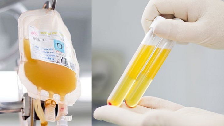 Huyết tương đục là gì? Nguyên nhân gây ra huyết tương đục? 1