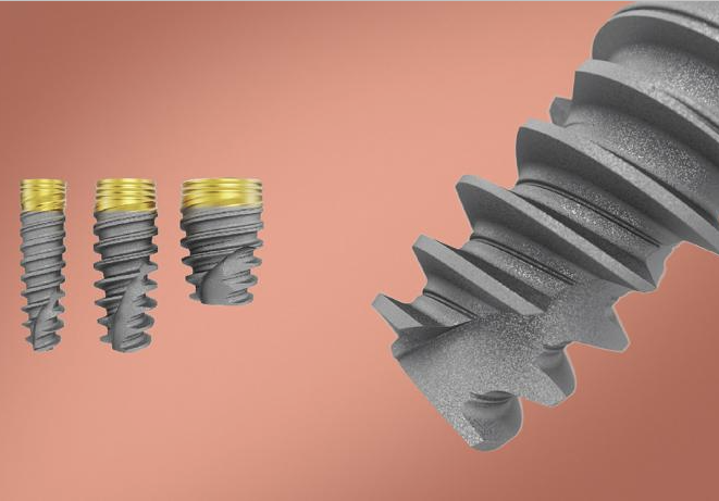 Trụ implant nobel biocare là gì? Có an toàn không? 2