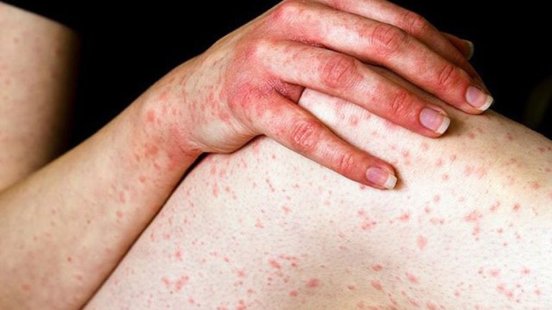 Indicator band (ind) là gì và được sử dụng như thế nào 1