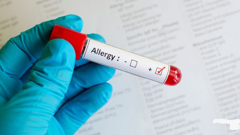 Indicator band (ind) là gì và được sử dụng như thế nào 4