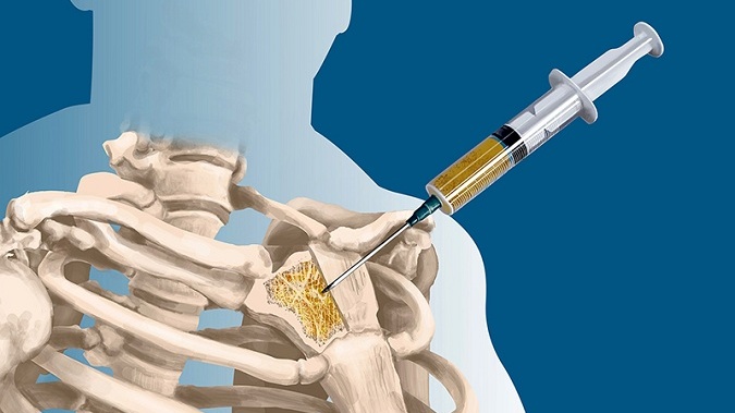 Kết quả sinh thiết có chính xác không? 1