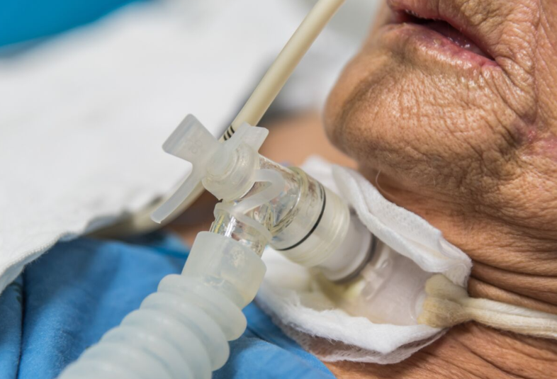 Khai khí quản là gì? Những điều cần biết về khai khí quản 2