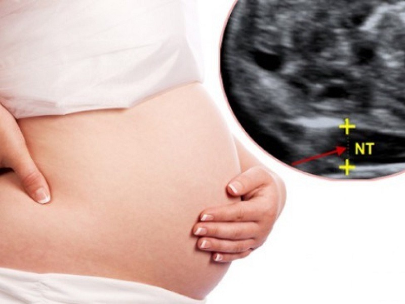 Khám sàng lọc dị tật thai nhi khi nào? 3