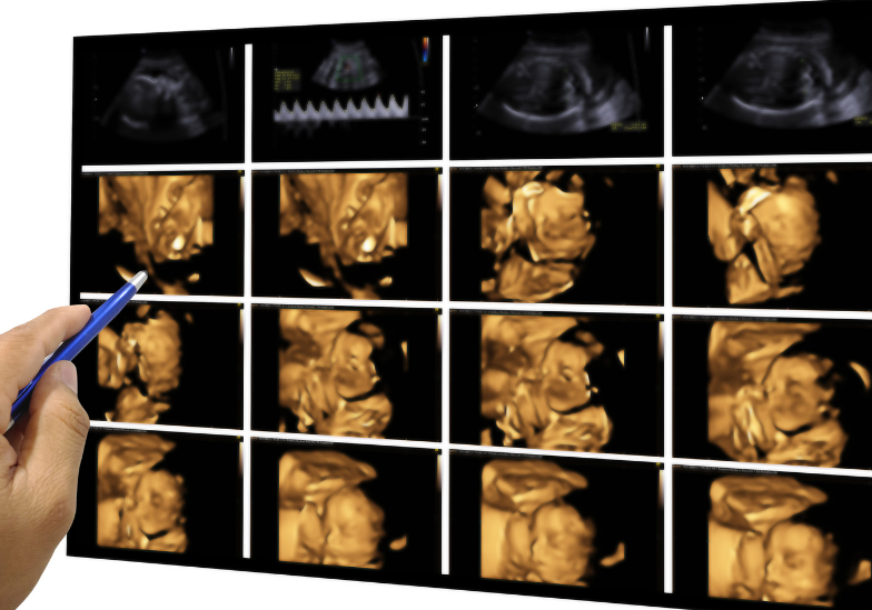 Khám sàng lọc trước sinh vào thời điểm nào? Các phương pháp thực hiện 4