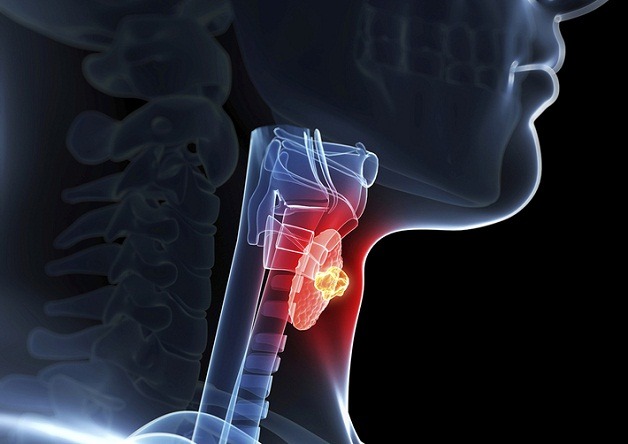 Khám tuyến giáp diễn ra như thế nào? Khi nào cần khám tuyến giáp? 1