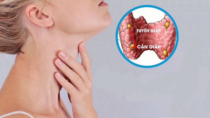 Khát nước liên tục là bệnh gì? Phải làm sao? 3