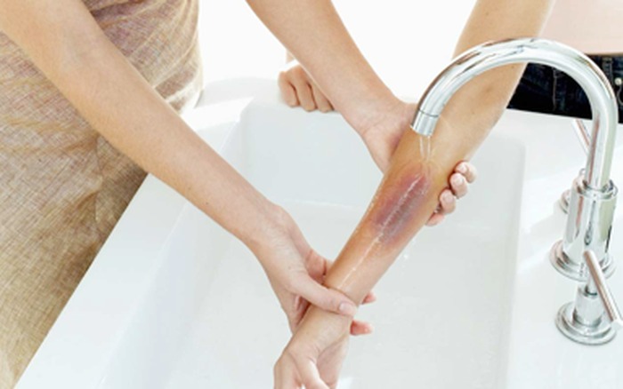 khi-bi-phong-bo-nen-lam-gi 3.jpg