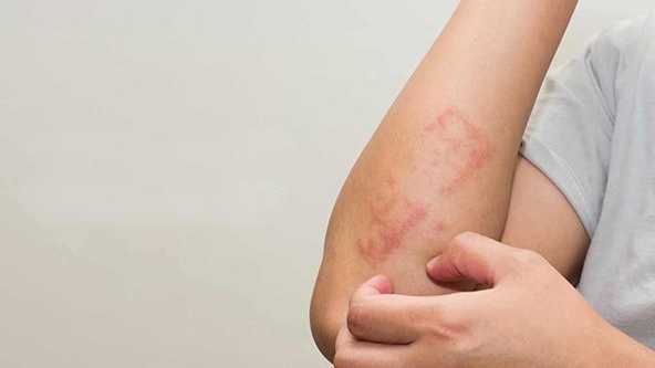 Khi nào cần phải chạy thận nhân tạo? 4