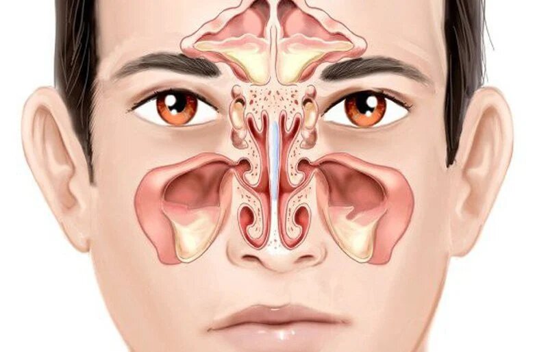 Khứu giác là gì? Những bệnh lý nào ảnh hưởng đến khứu giác? 2