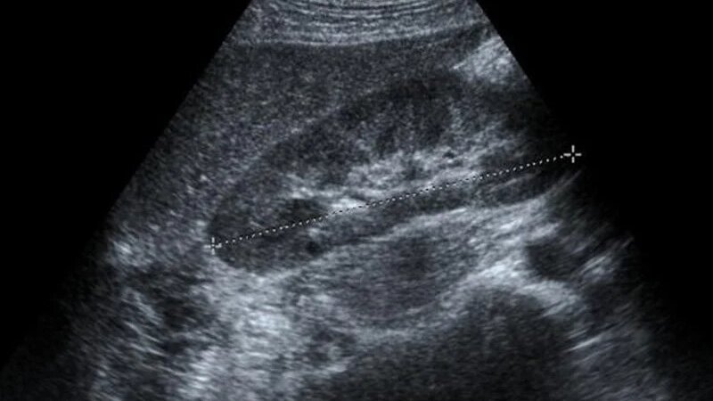 kich-thuoc-gan-binh-thuong-tren-sieu-am-la-bao-nhieu 1.jpg