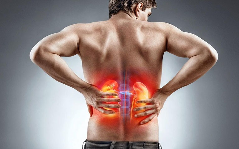 Kích thước nang thận to bao nhiêu thì phải mổ? 3