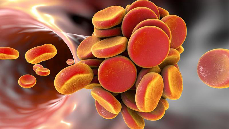 Kiwi vàng có tác dụng gì? Kiwi vàng hay xanh tốt hơn? 3