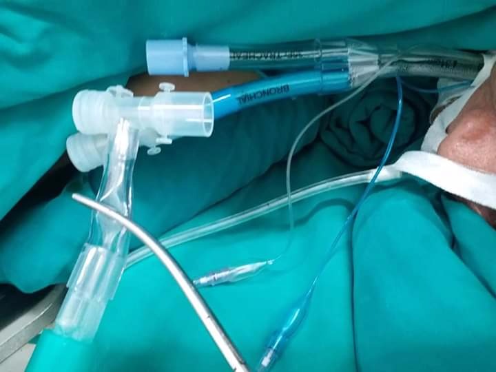 ky-thuat-dat-ong-noi-khi-quan-2-nong-la-gi 1.jpg