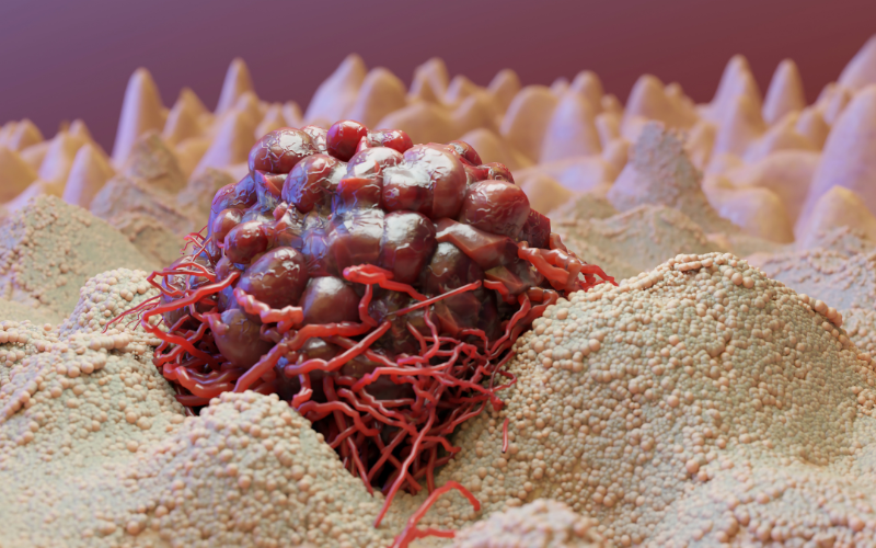 Liệu ung thư có di truyền không? 1